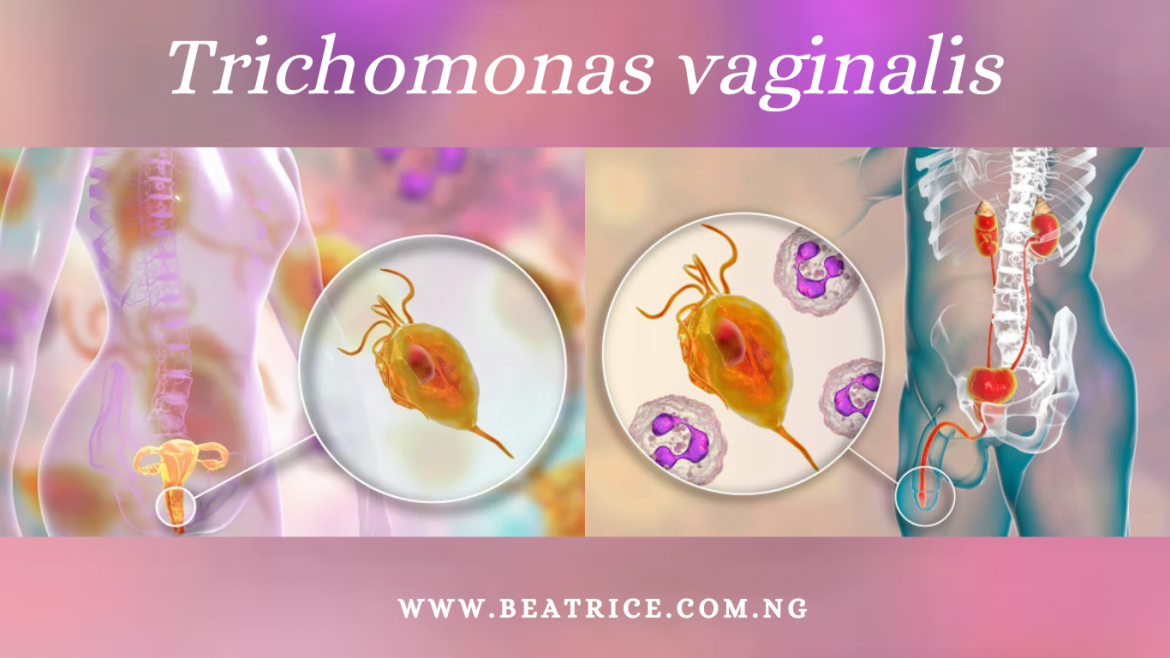 Confronting Trichomonas vaginalis – A Journey Through Detection and Treatment